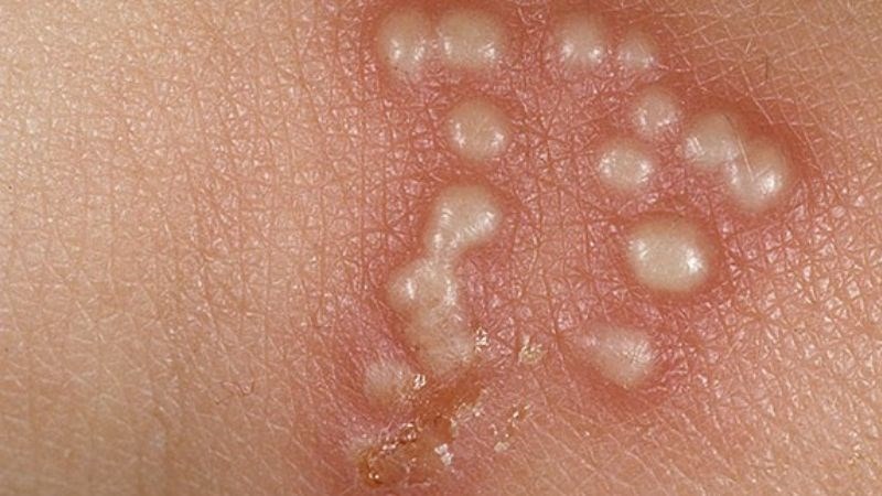 8 Dấu Hiệu Dưới Da 2