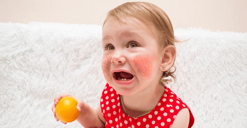 Làm Sao Để Phát Hiện Trẻ Bị Dị Ứng Thực Phẩm 1