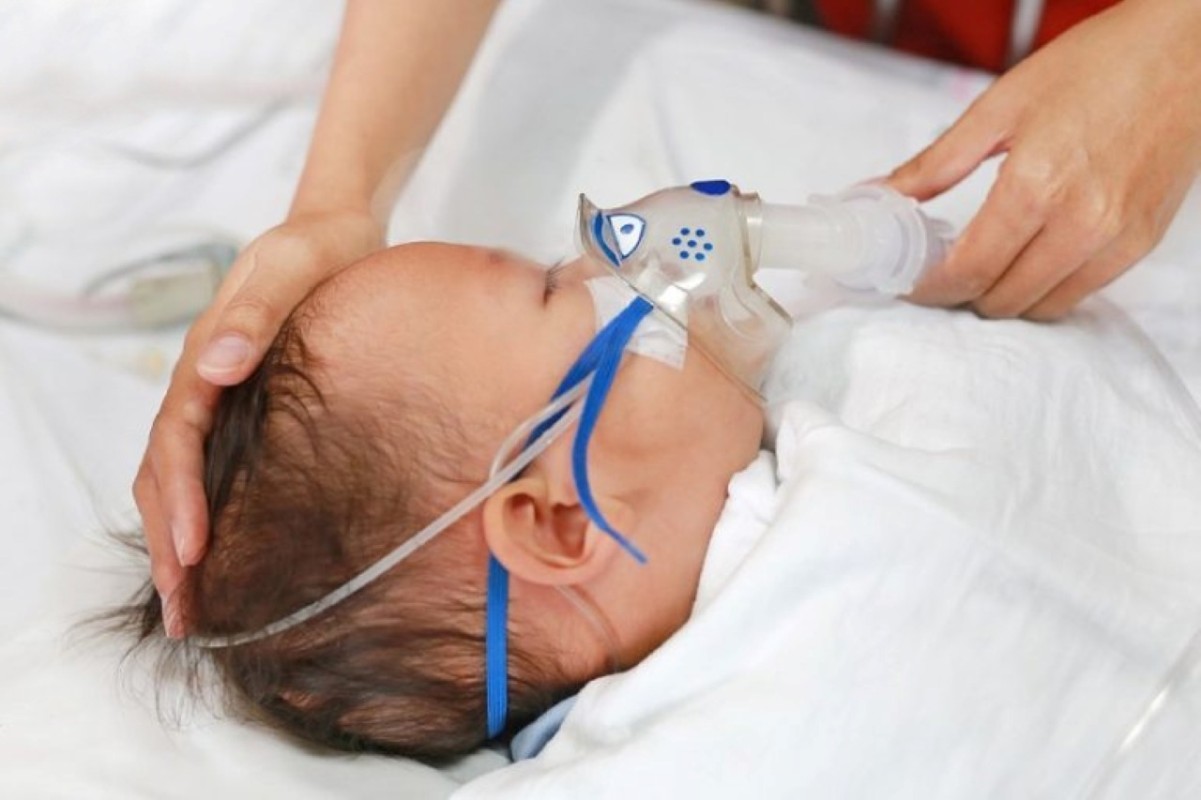 Nguyên Nhân Khiến Trẻ Dễ Mắc Viêm Phế Quản Cấp 3
