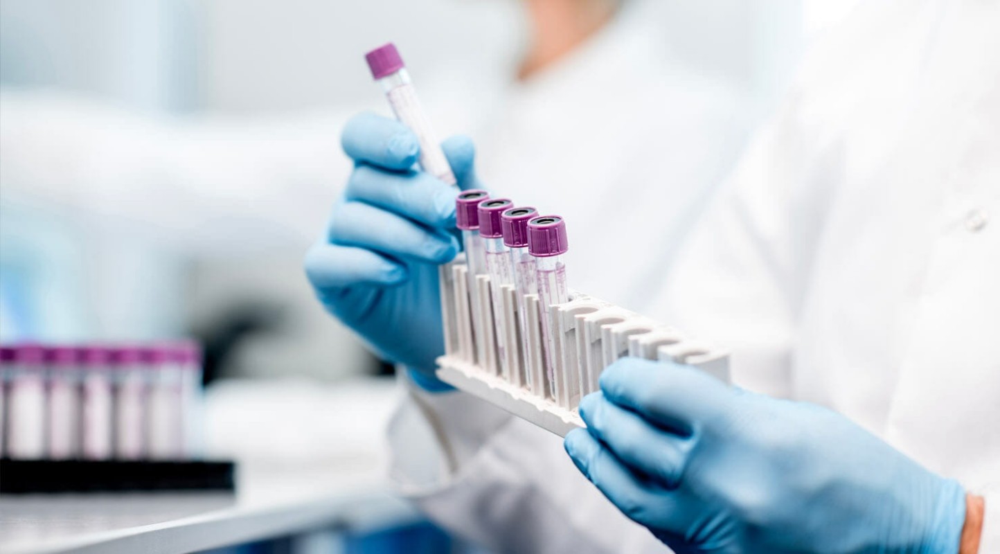 Tầm Quan Trọng Của Việc Kiểm Tra Nội Tiết Tố Định Kỳ 3