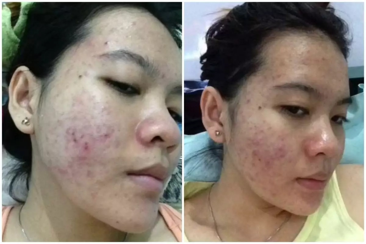 Sát thủ thầm lặng 2